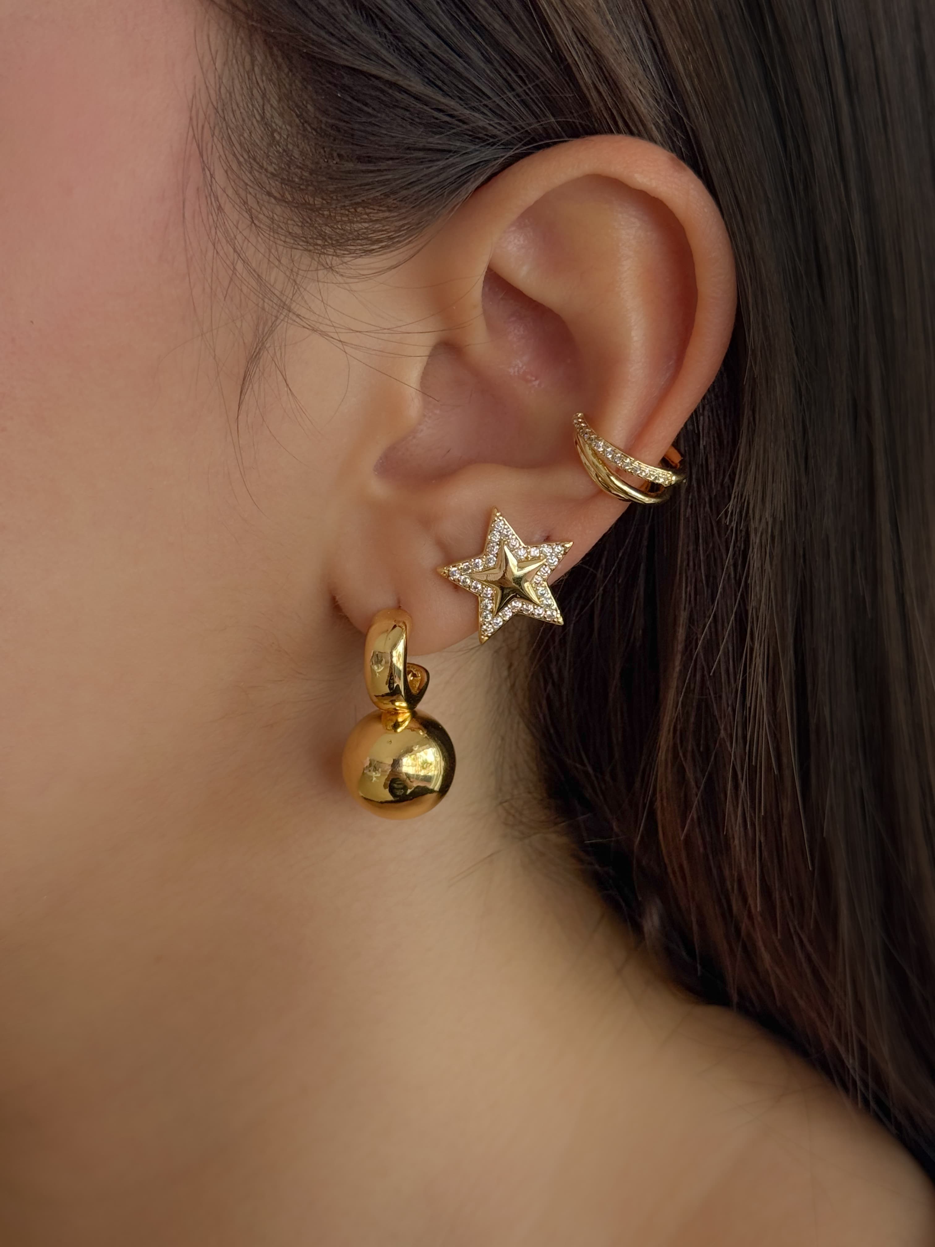 ARETE BETI